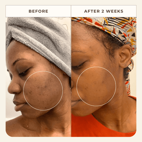 Neroli Clarifying Complexion Mist